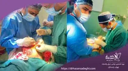 تفاوت های پیکر تراشی با جراحی های لاغری