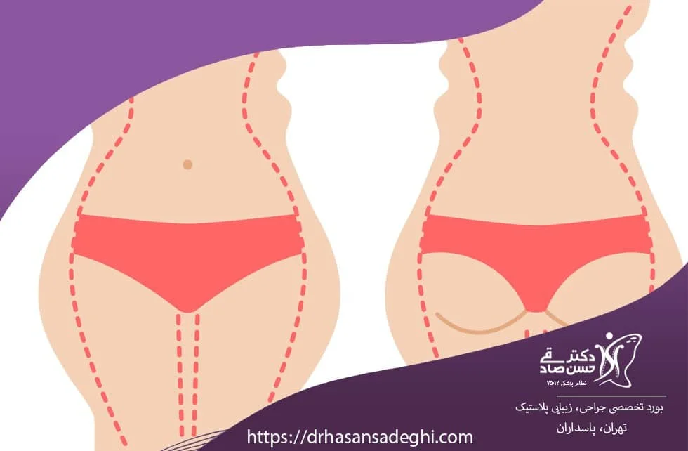 آشنایی با پیکرتراشی