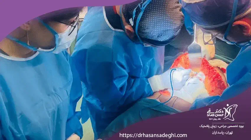 جراحی شکم یا ابدومینوپلاستی